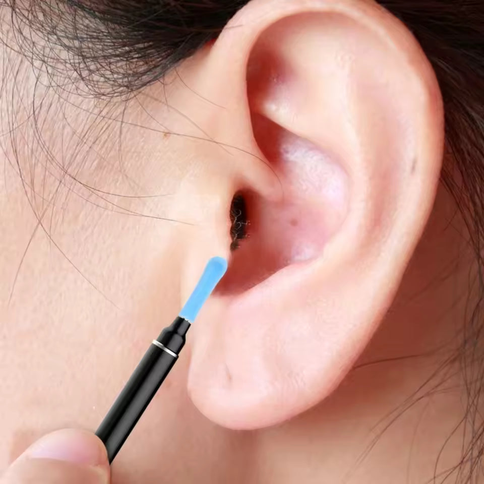 Visual Earpick Replacement Tips – Refill Pack